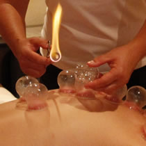 Schröpfen Details Schröpfen Details